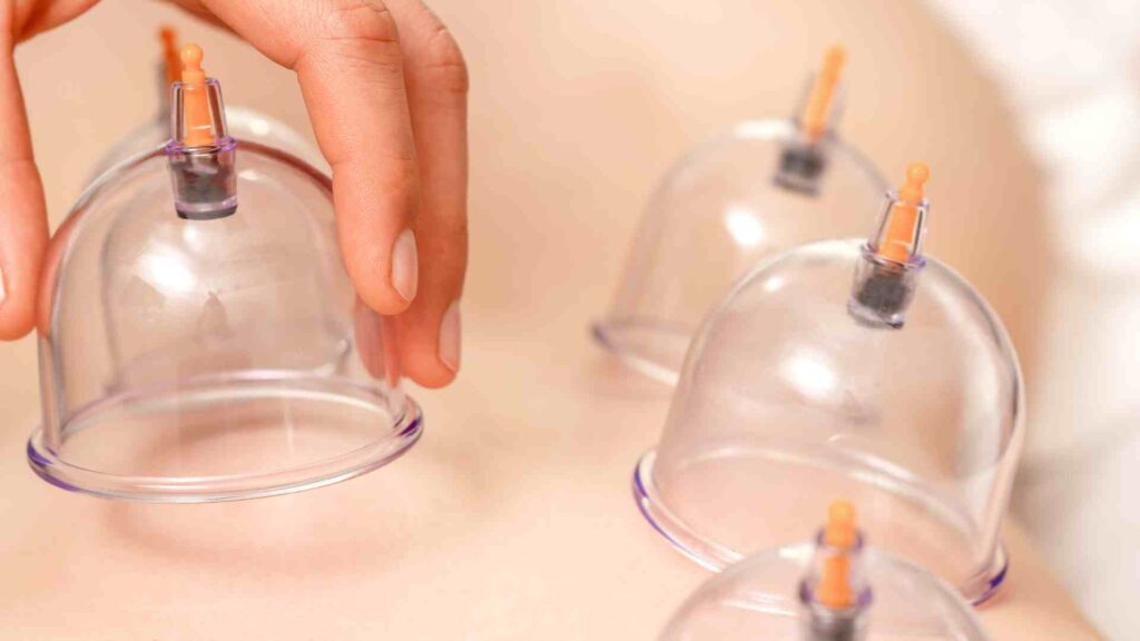 cupping_massage_in_salt_lake_city