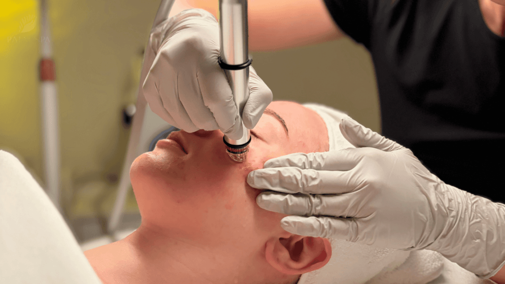 hydrodermabrasion facial