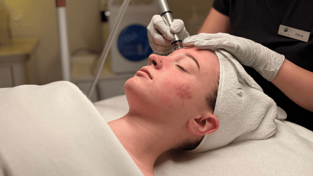 hydrafacial